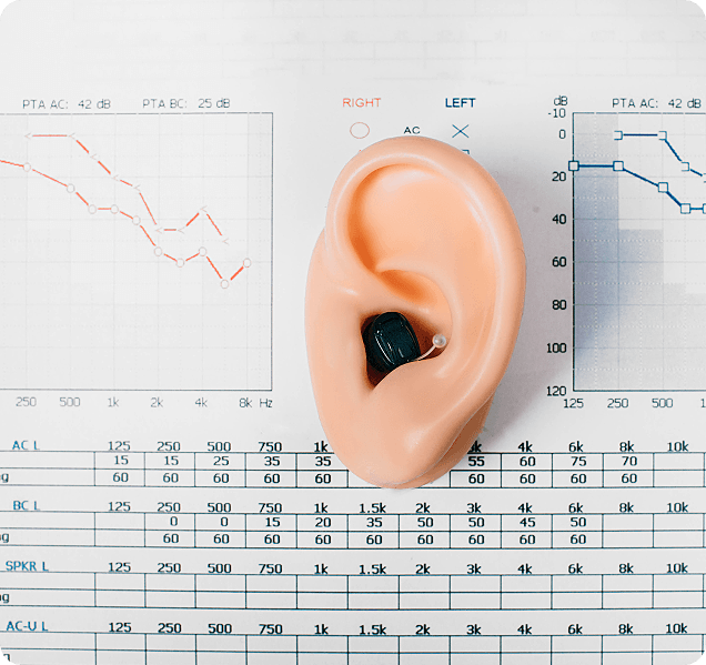 Understanding Hearing Loss